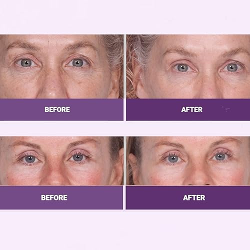 Miniatura 5 de INSTA-TOX - Suero reafirmante facial suavizante de arrugas y crema reafirmante para ojos, tensor para líneas, arrugas profundas y poros, elevación