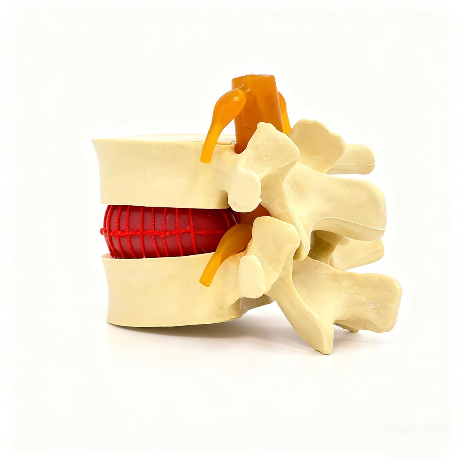 YXHXWKJ Human Anatomical Lumbar Disc Herniation Model-1.5 Times Life Size Lumbar Disc Teaching Model Tool For Medical &Teaching & Learning And Scientific Presentations(Bone yellow)