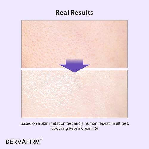 Miniatura 2 de DERMAFIRM Crema reparadora calmante R4 de 1.69 onzas, crema facial para problemas de piel, con eucalipto, péptido y collage, suave para todo tipo de