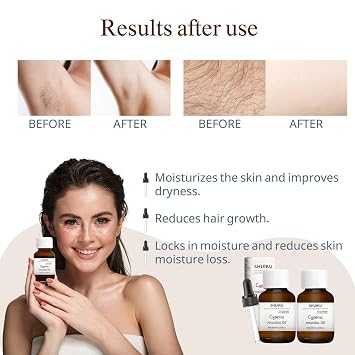 Cyperus Rotundus Oil for Hair Removal 2 PACKS 100% Pure Natural Cyprus Oil Organic Herbal Cypress Root Extract for Smooth Skin, Reducing Body Hair Growth, Ingrown Hair & Nourishment 60ml