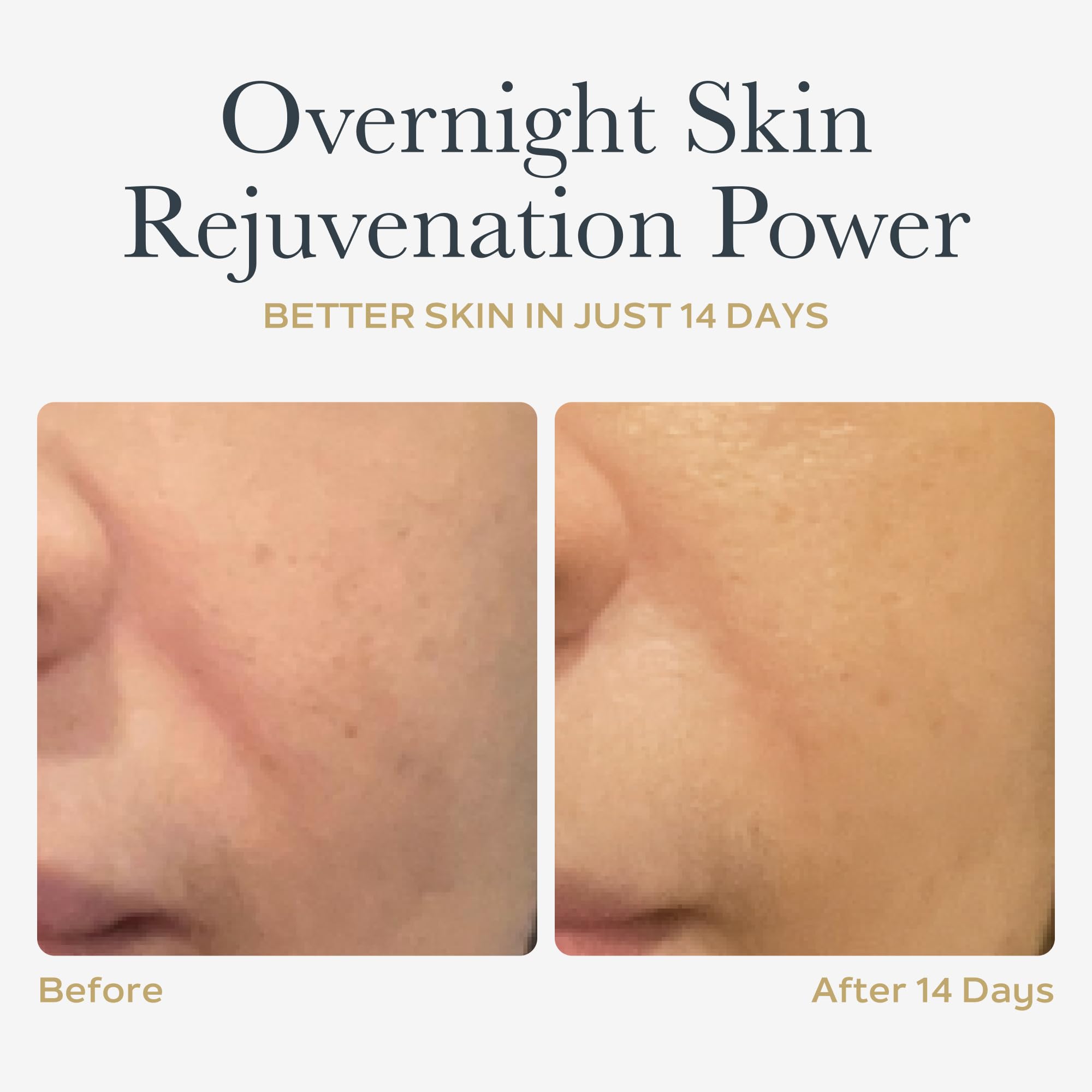 SOTHYS Renovative Micro-Capsules - Vitamin C Serum for Face | Vegan Capsules | Anti-Aging, Dark Spot | Night Treatment | 60 x .01 Fl Oz