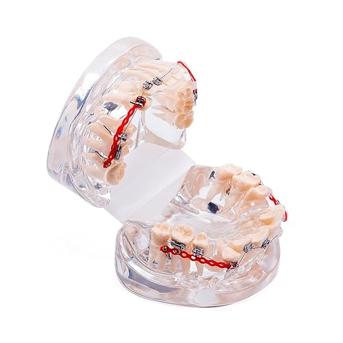 Miniatura 6 de Easyinsmile Modelo de tratamiento de ortodoncia dental modelo de dientesdientesdentaduras con soportes para dentistas que estudian investigación y