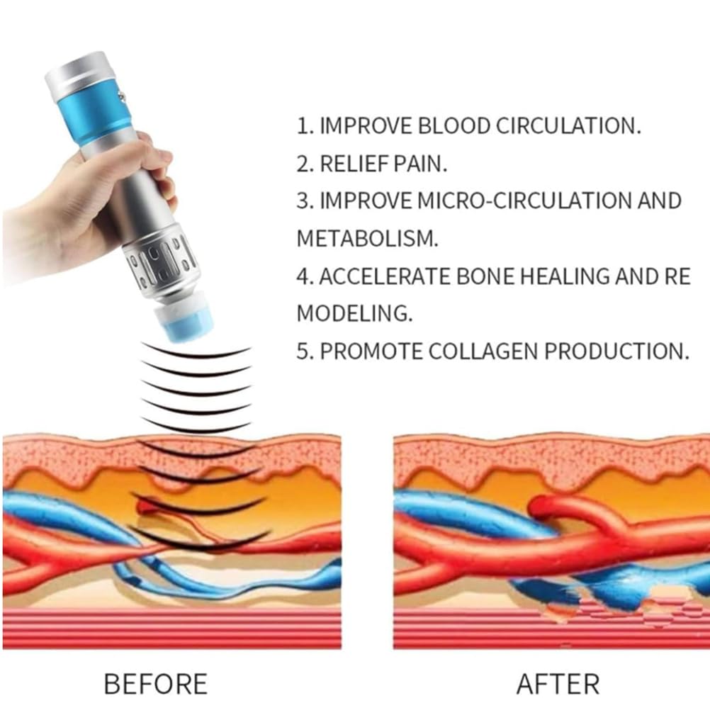 BCBKD Macchina di Terapia Ad Onde D'urto, con 10 Teste di Massaggio,per Terapia Ad Onde D'urto Radiali Extracorporee per Il Rilassamento dei Muscoli del Corpo, Sollievo dal Dolore, Bellezza,220V