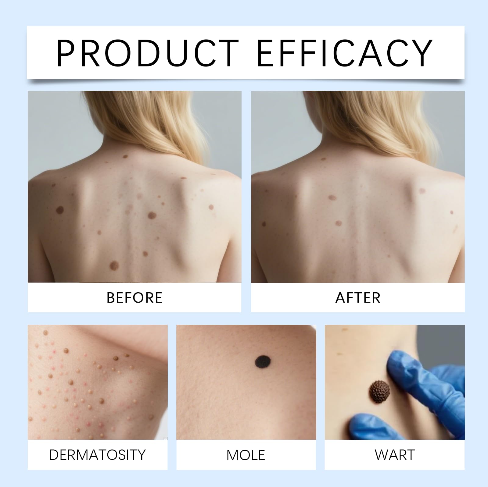 Skin Tag Remover,7 Day Spot and Tag Remover, 7-Tage Hautflecken und Hautanhängsel Entferner, Skin Tag Entferner, Hautfleckenentfernungsstift für Gesicht und Körper ，3PCS
