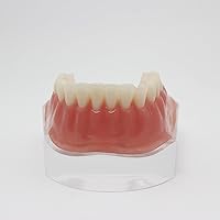 Vista 8 de Color dorado dental del diente inferior de la sobredentadura del implante de la precisión 4 modelo de los dientes