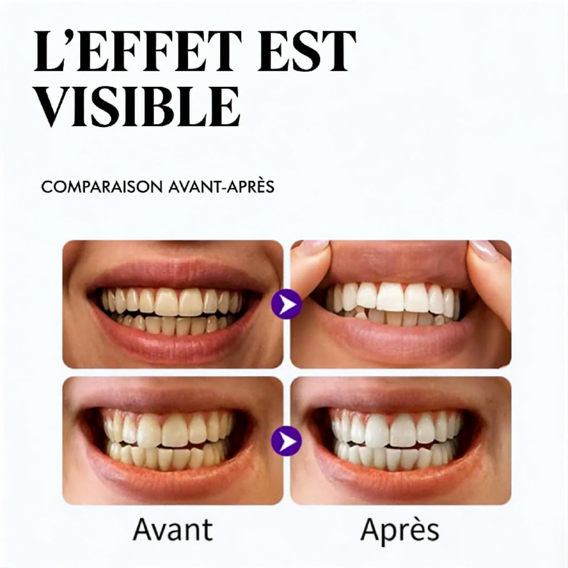 DrDent Purple Whitening Strips, Bande De Blanchiment des Dents, 42 pièces (1 Pièce - 42 Pièces)