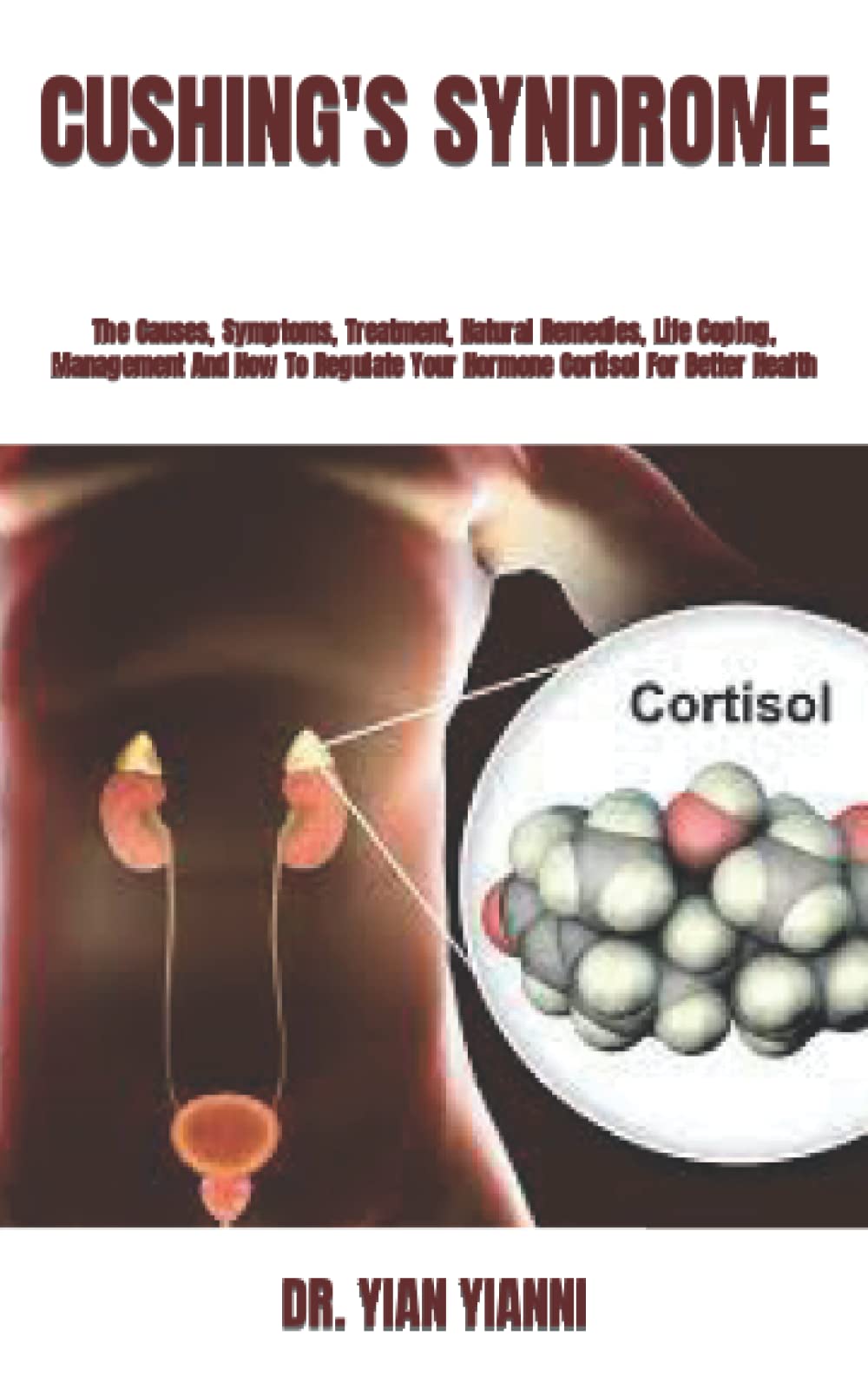 Buy CUSHING'S SYNDROME The Causes, Symptoms, , Natural Remedies, Life