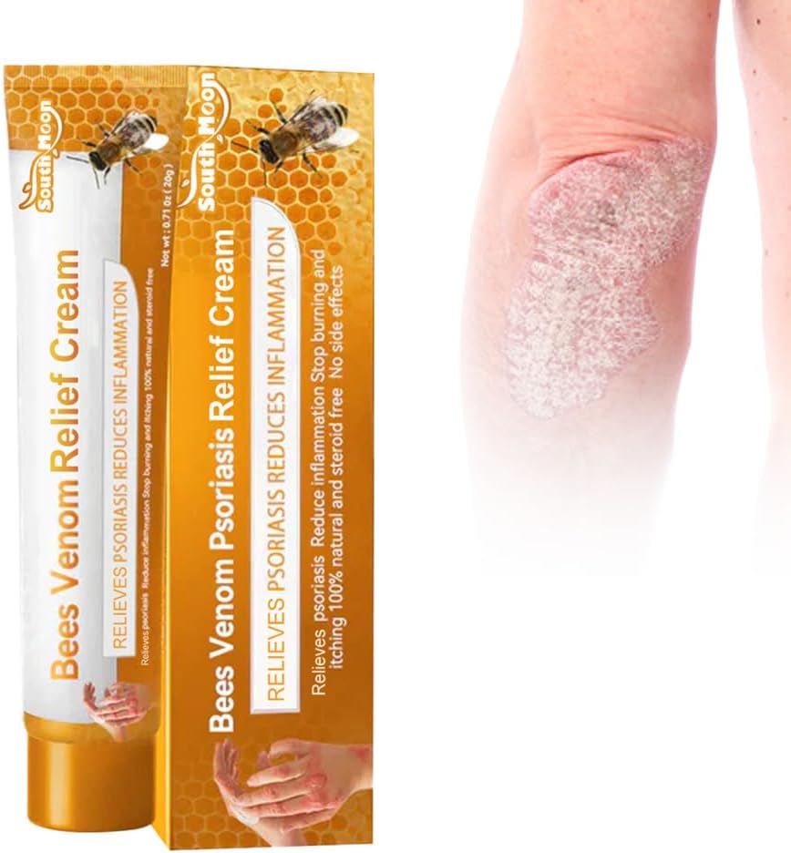 Laluerck 20 g natuurlijke psoriatische verlichtende crème effectieve zalf tegen jeuk stopt psoriatische jeuk en schilferende roodheid