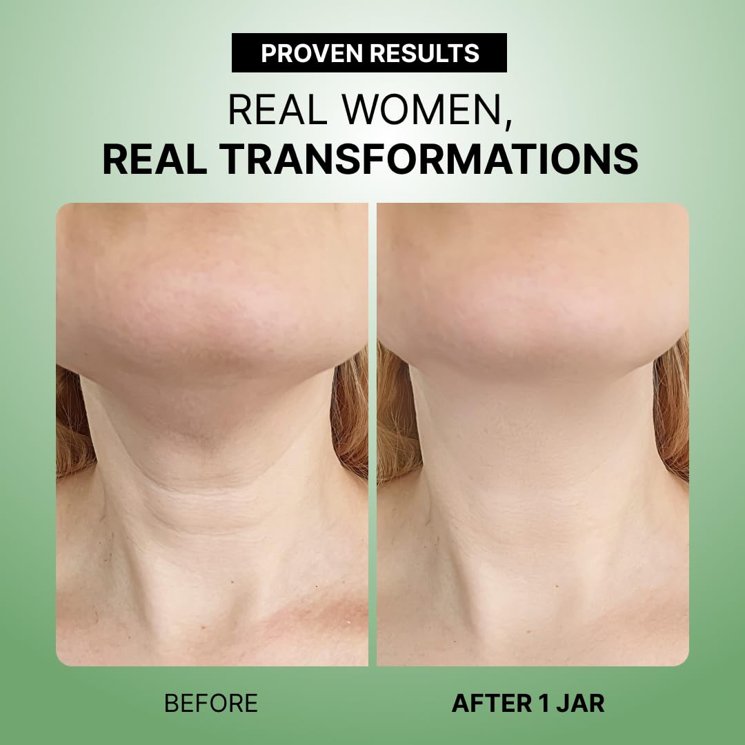 Neck Firming Cream – Advanced Anti-Aging Moisturizer for Sagging Skin, Wrinkles & Crepey Neck - Daily Lifting & Tightening Formula for a Youthful Décolleté From Home -30ml - Image 2