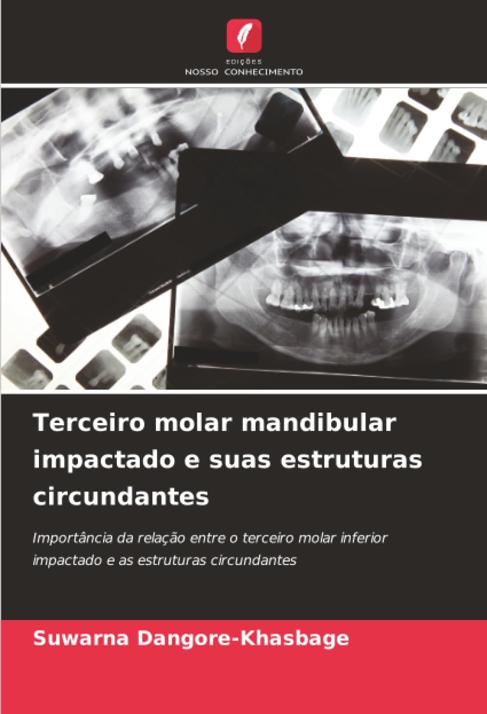 Terceiro molar mandibular impactado e suas estruturas circundantes: Importância da relação entre o terceiro molar inferior impactado e as estruturas circundantes