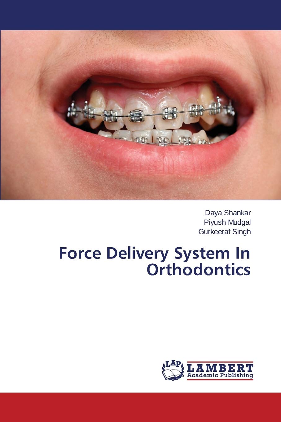 Force Delivery System In Orthodontics