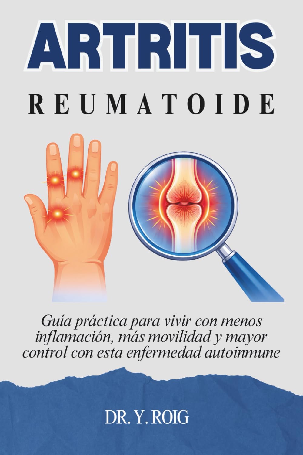 Artritis reumatoide: Guía práctica para vivir con menos inflamación, más movilidad y mayor control con esta enfermedad autoinmune