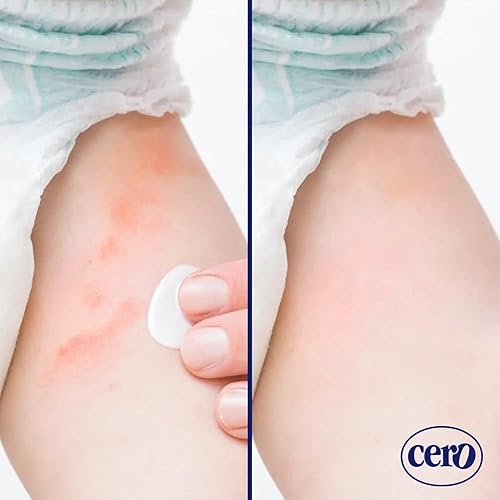Miniatura 6 de Crema Cero para erupciones de pañales para bebé con óxido de zinc y aloe vera - Crema de pañales de alta resistencia para un alivio y protección
