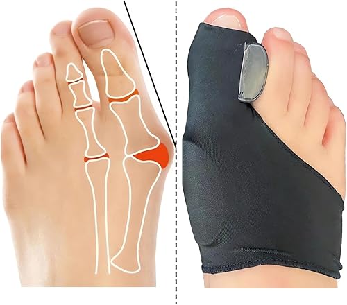 Miniatura 6 de 2 pares de calcetines correctores de juanetes  2023 nuevos calcetines Orthoes para alivio de juanetes para mujeres y hombres, cómodos corrector