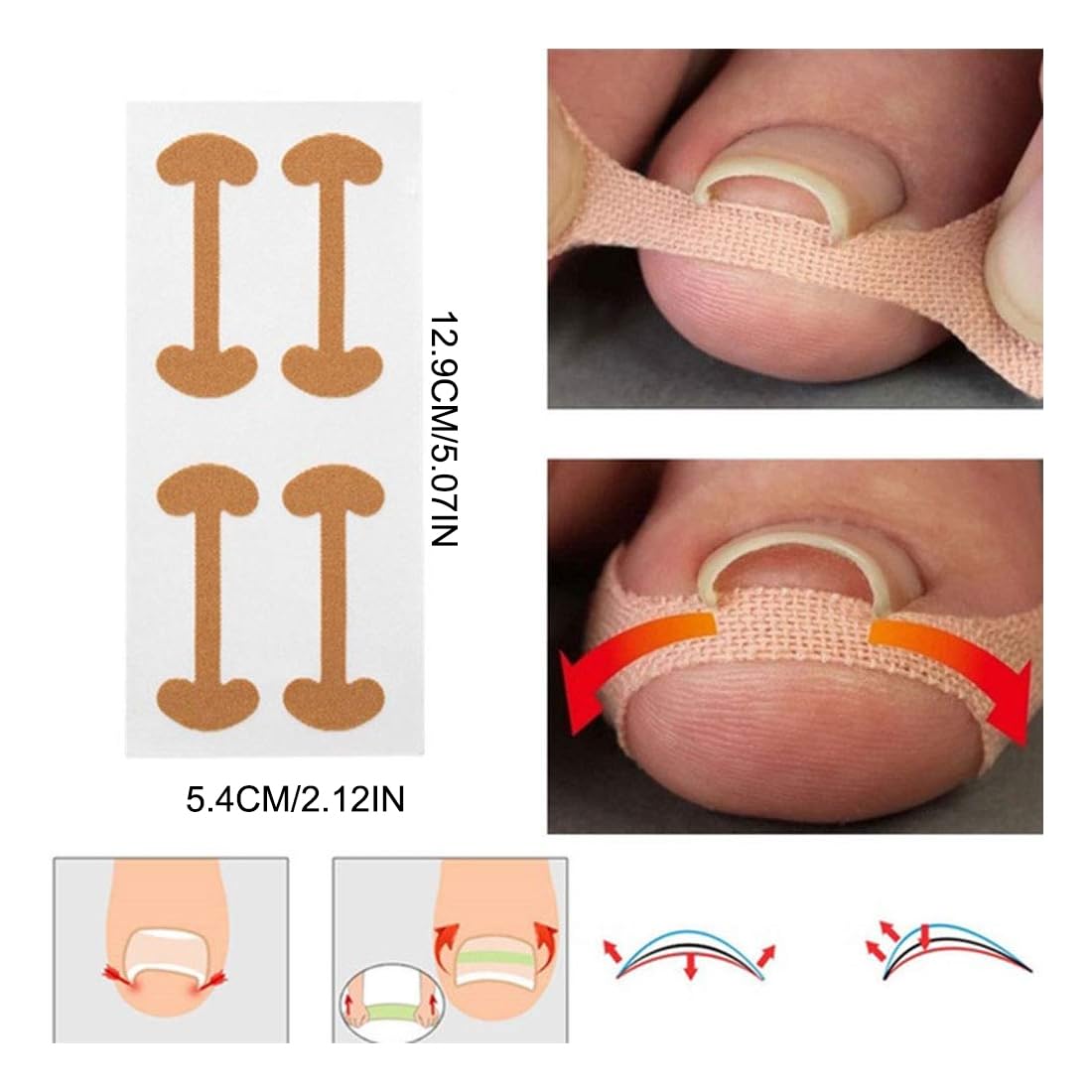 50 Foglio Correttore per Unghie Incarnite, Cerotti per Unghie, Unghia Incarnita Alluce, Unghie Incarnite Piedi, Strumenti per Pedicure, Cerotto per Unghia Incarnita