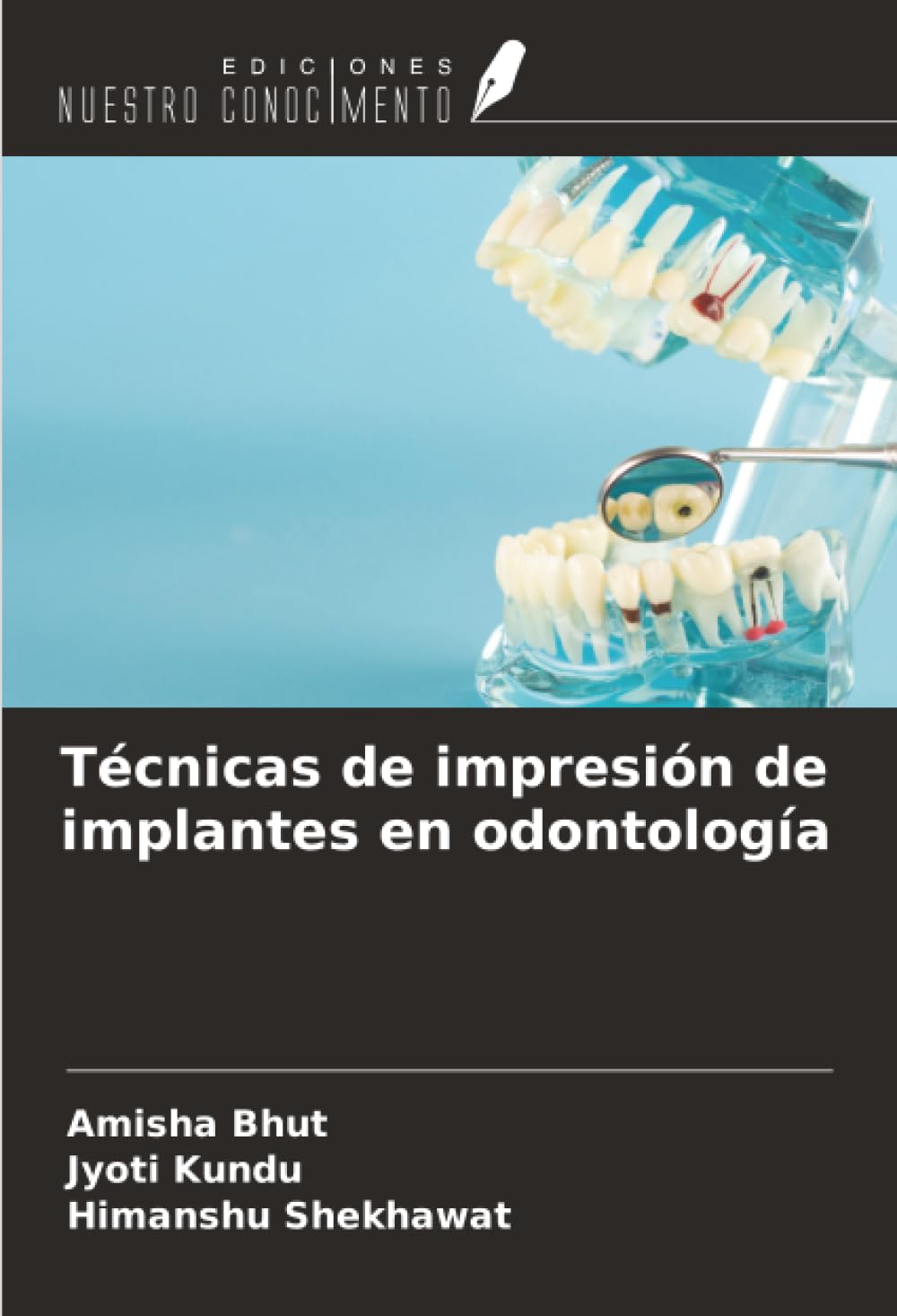 Técnicas de impresión de implantes en odontología