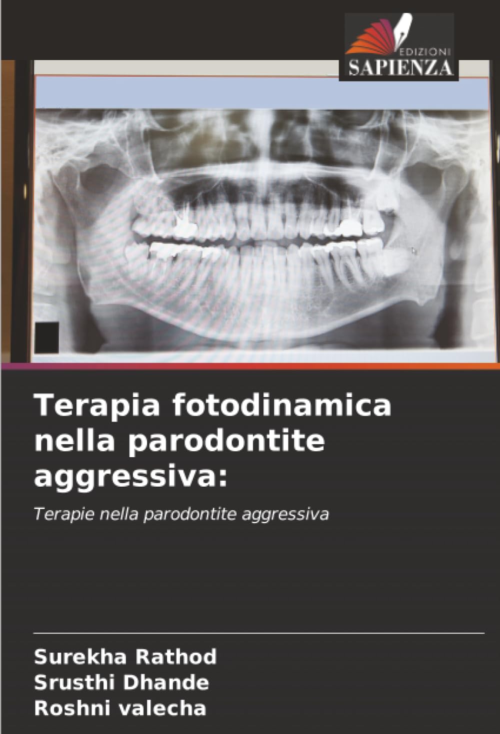 Terapia fotodinamica nella parodontite aggressiva:: Terapie nella parodontite aggressiva