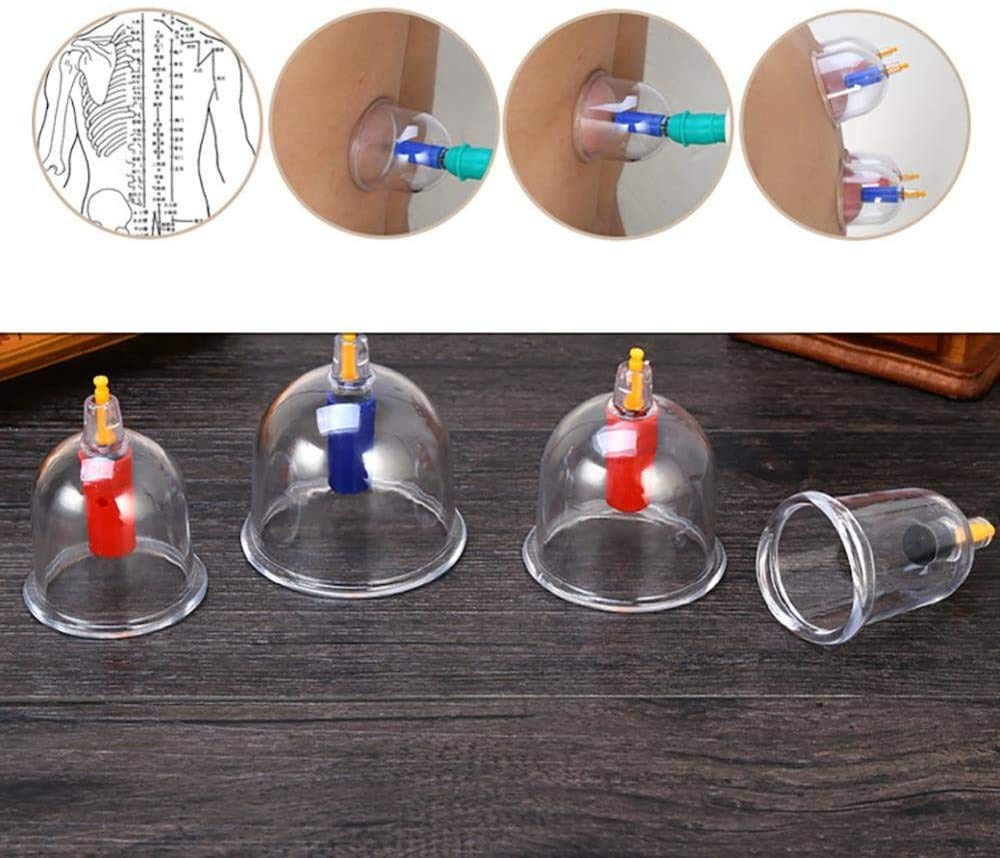 ALIQI Set di 24 coppette sottovuoto, professionale cinese, terapia di coppettazione tradizionale cinese