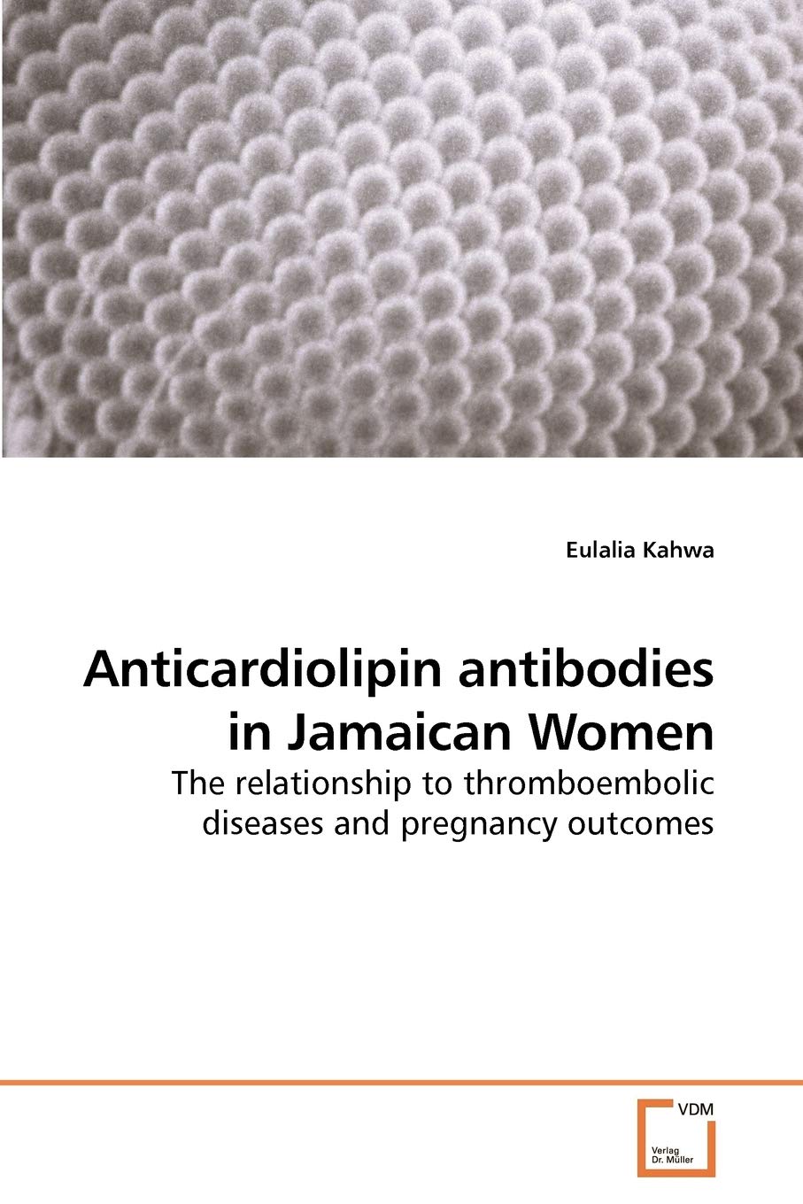 Anticardiolipin antibodies in Jamaican Women: The relationship to thromboembolic diseases and pregnancy outcomes