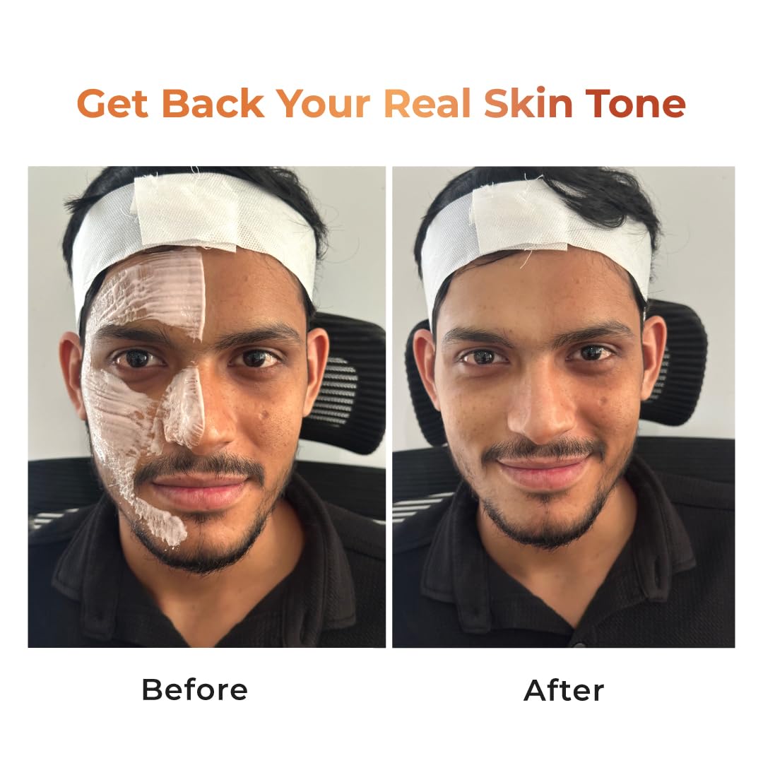 NICONI Tan Vanish Gluta-Kojic Skin Polish | Instant Tan Removal & Glow | Infused with Kojic Acid & Glutathione | Ideal for All Skin Types | Lightens Suntan | 180g