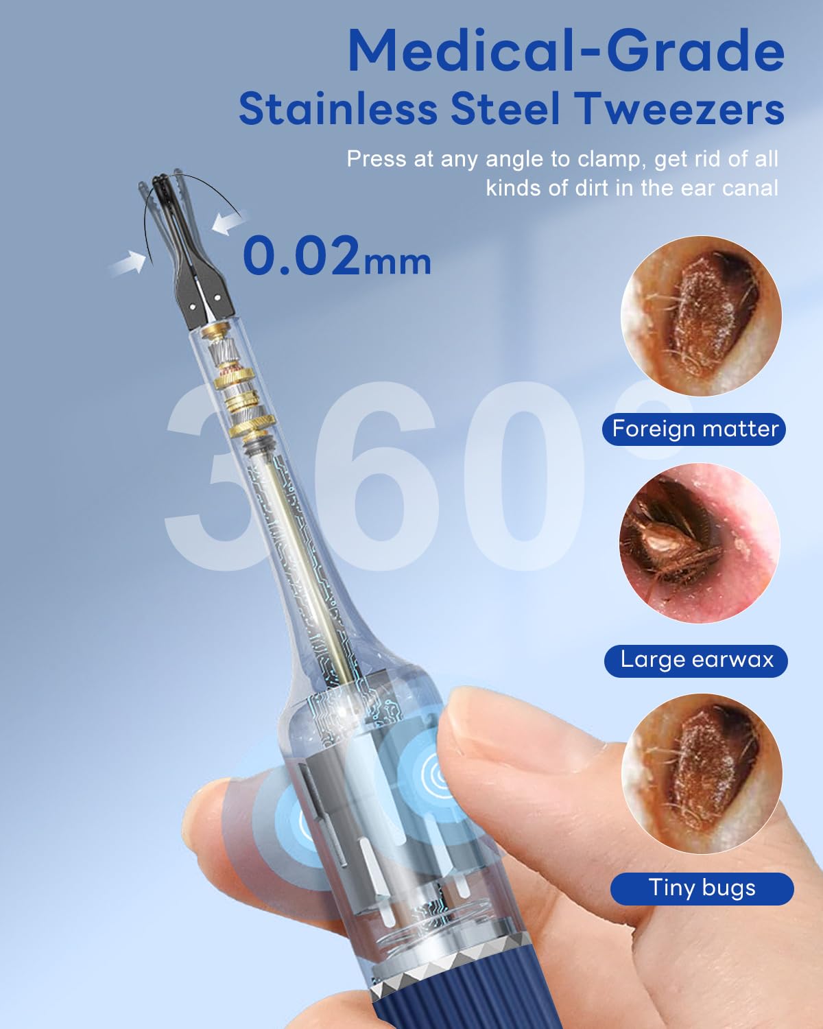 MEKK Ear Wax Removal Kit S5 with 10 MP Camera, Precision Tweezers, 12 Ear Spoons, Wireless Otoscope Ear Cleaner for iOS & Android