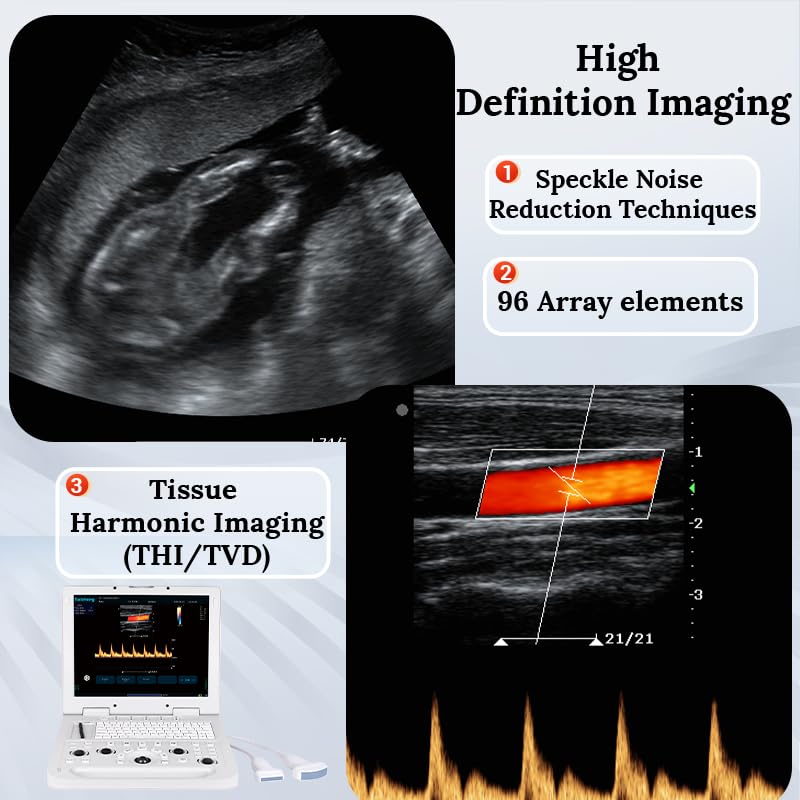 ultrasound machine heavy duty 949