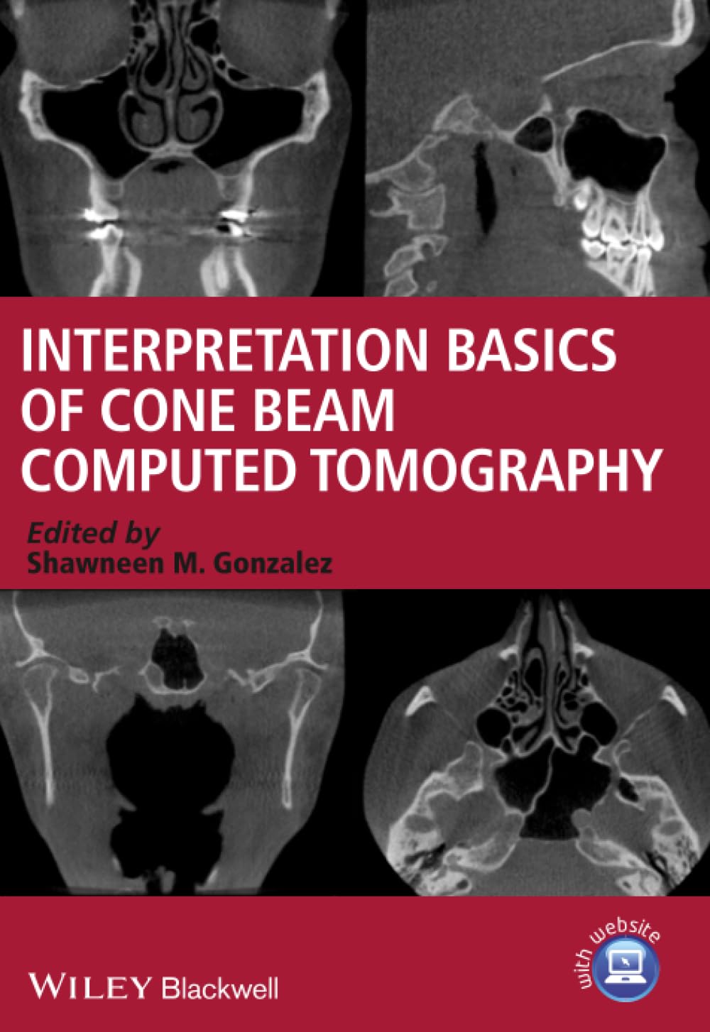 Interpretation Basics of Cone Beam Computed Tomography