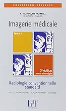 Download Imagerie médicale : Radiologie conventionnelle standard - Tome 1, 3ème édition PDF