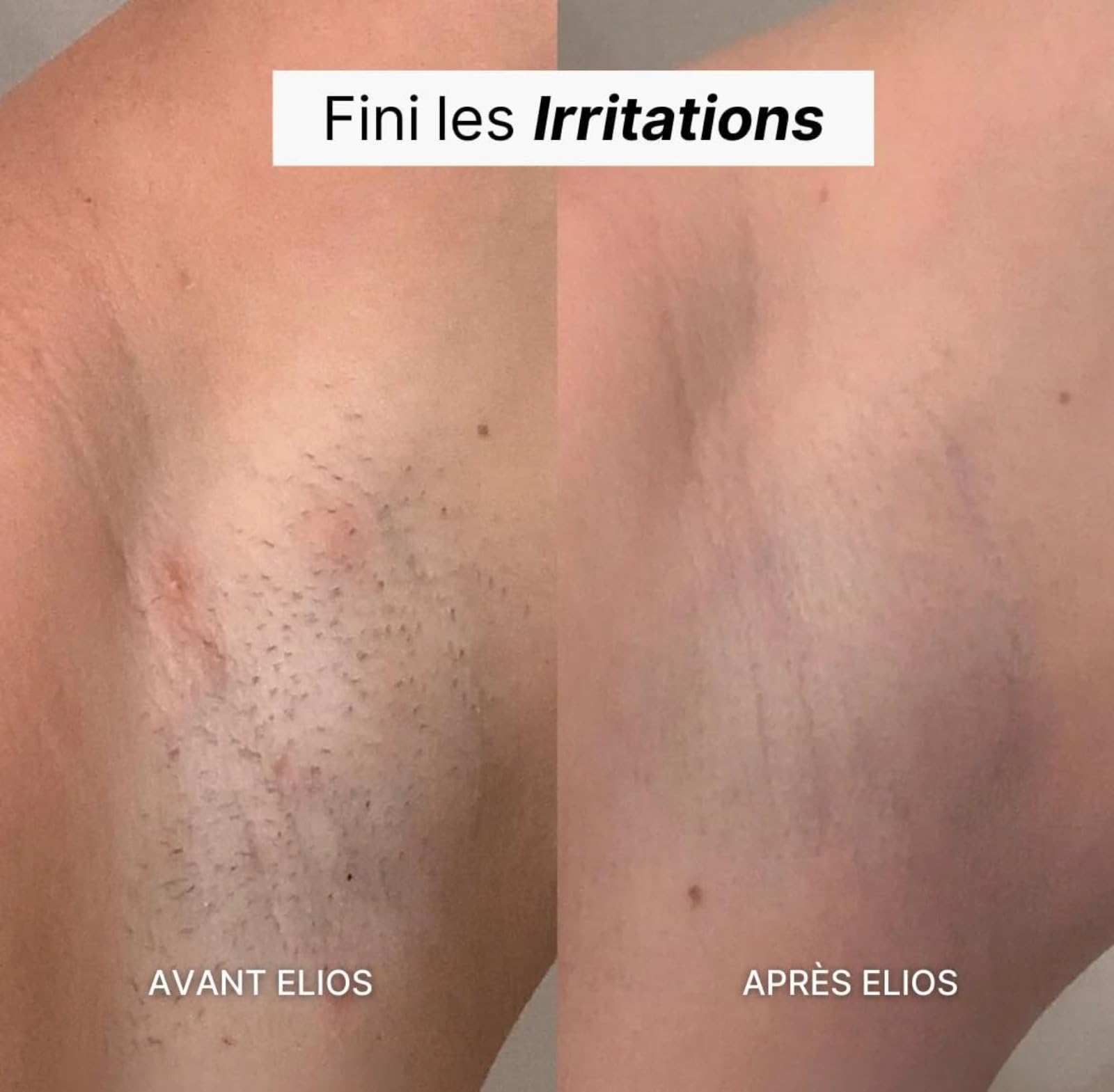 Rasoir Electrique Femme,Rasoir Elios Femme 5 En 1,Rasoir Femme,Épilateur Électrique avec Affichage LED et Chargement USB,IPX7 Étanche, pour Bikini,Aisselles,Jambes,Nez(Disponible en trois couleurs)