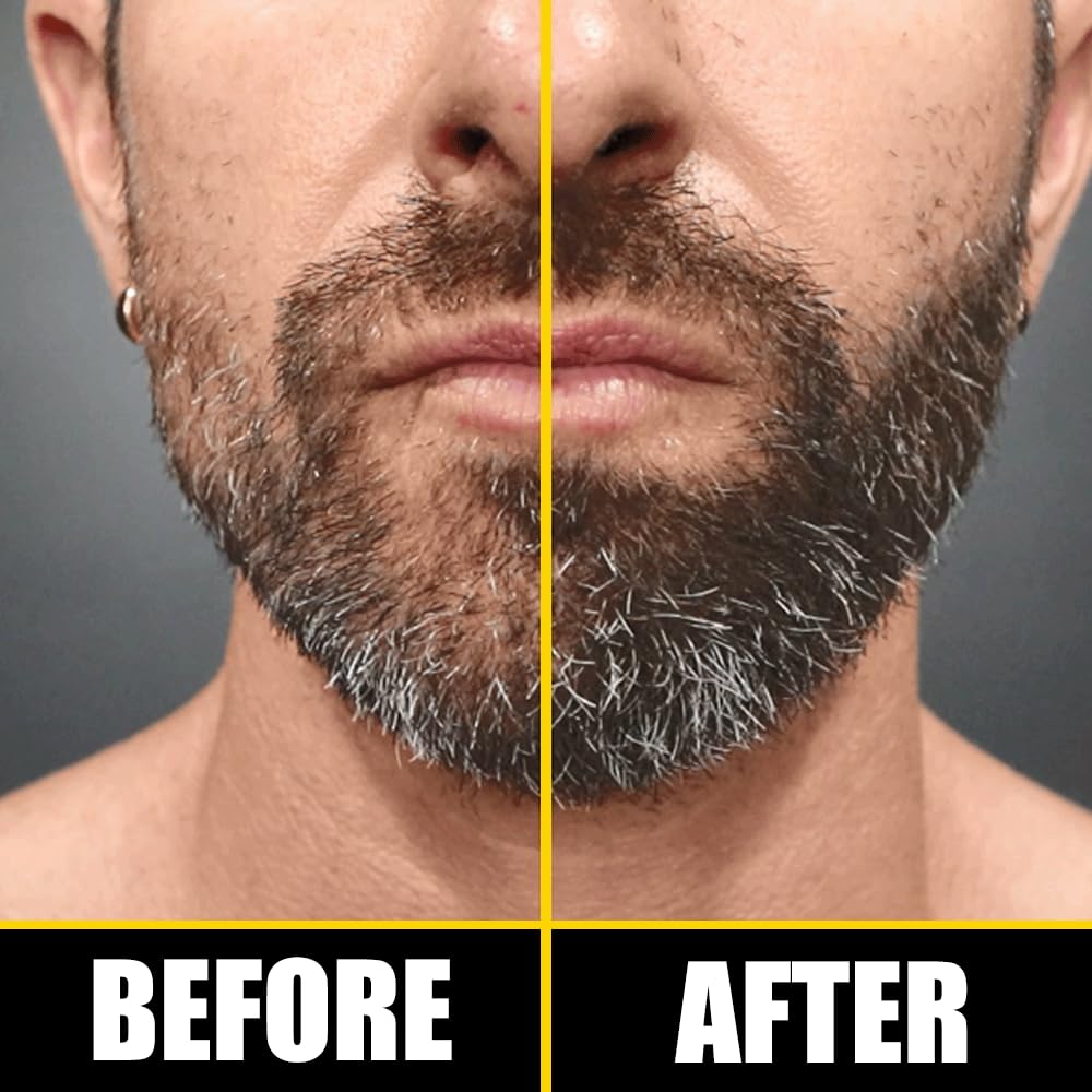 Pete & Pedro BOOST Hair & Beard Strengthening & Growth Natural Scalp Health Serum Oil For Men & Women - With Rosemary, Biotin & 20 plus Essential Oils | Shark Tank Featured, 2 oz. - Image 7