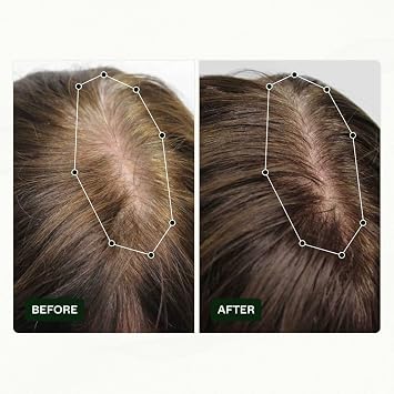 Scandinavian Biolabs Hair Strength Shampoo and Bio-Pilixin Activation Serum for Women | Powerful Formula to Strength Hair with a Gentle Cleanse | Moisturize Scalp & Hair, Eliminate Greasiness