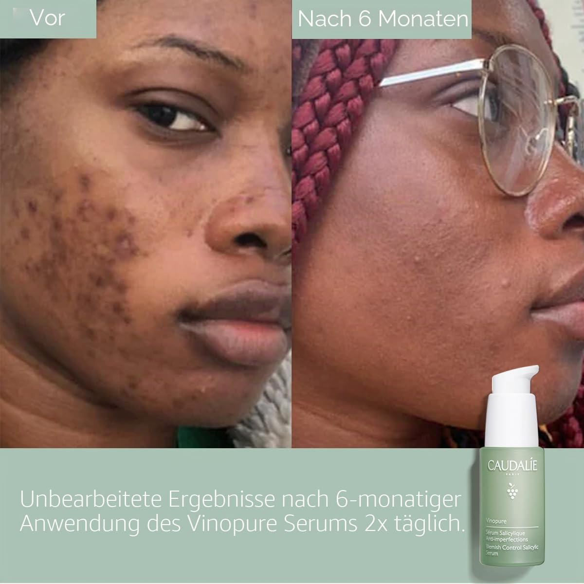 Caudalie Vinopure Serum mit Salicylsäure gegen Unreinheiten – 30 ml