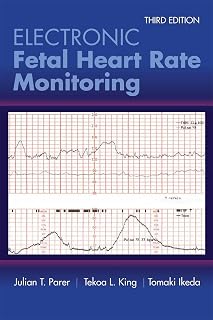 Electronic Fetal Heart Rate Monitoring: The 5-Tier System: The 5-Tier System