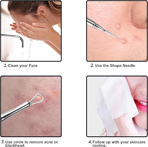 Miniatura 6 de Eliminación profesional de milia facial y extractor de puntos blancos y lanceta - Bucle circular de doble extremo y herramienta para reventar