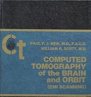 Computed tomography of the brain and orbit (EMI scanning) 068306455X Book Cover
