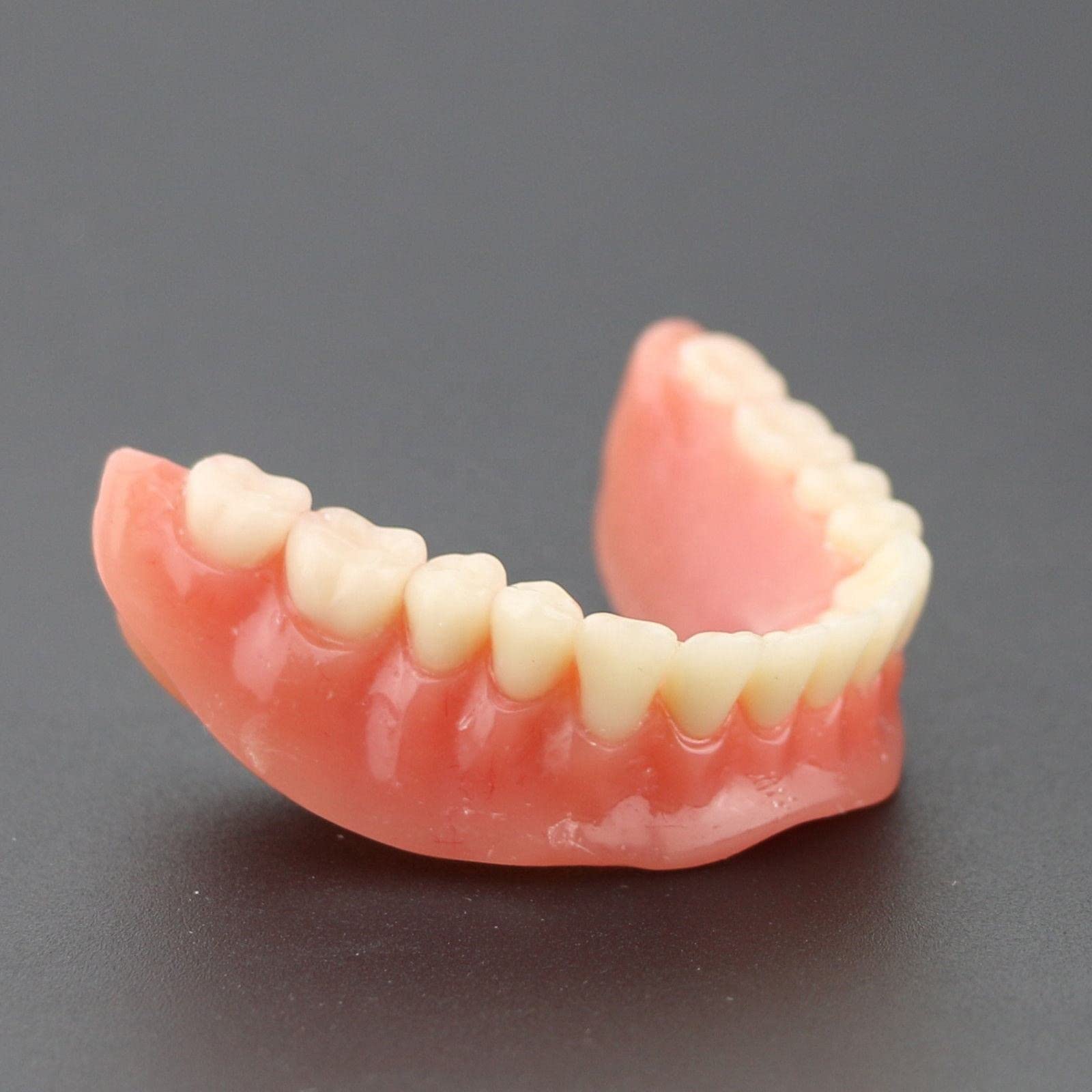 Modelo de sobredentadura Dental, modelo de dientes de enfermedad de implante, demostración de 2 implantes, para enseñar, estudiar, mostrar, comunicación con el paciente