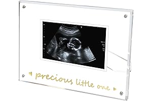 A5 Magnetic Live Ultrasound Picture Frame: Eternalize Your Precious Memory