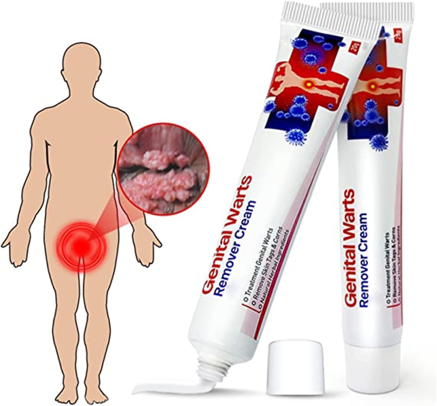 Remover Wart Ointment Genital Genital Vulva Condyloma Acuminatum,Remover Wart Ointment Genital, Genitals Wart Treatment Cream, Plantar and Genital Wart Treatment (2pcs)