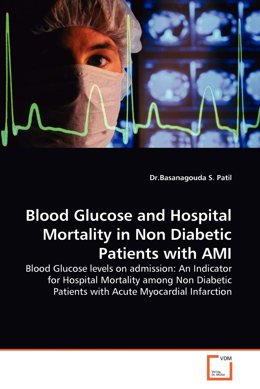 Blood Glucose and Hospital Mortality in Non Diabetic Patients with AMI