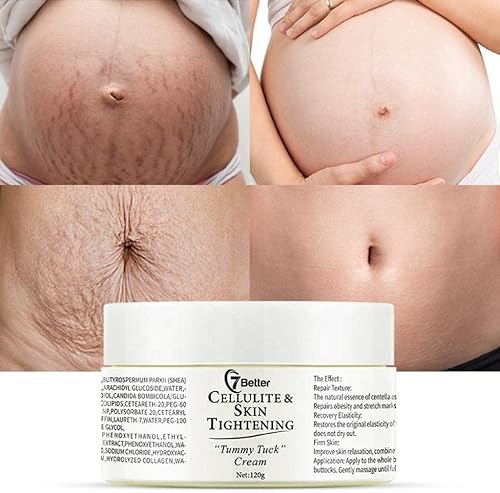 7better LLC Crema para eliminar estrías y cicatrices durante el embarazo: repara