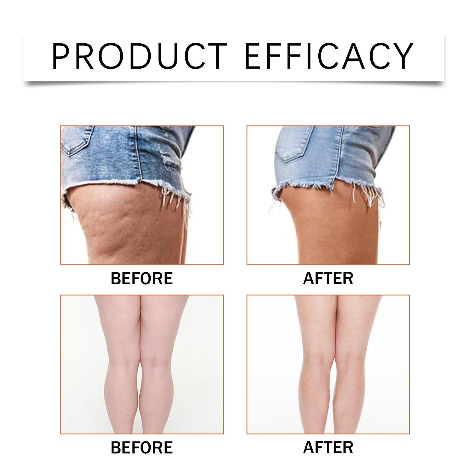 30 Stück Tape zur Oberschenkelstraffung,Instant Thigh Lifting Tape,Transparente Klebestreifen Oberschenkelstraffungen,Unsichtbare Beinstraffungs Aufkleber,Straffungs-Oberschenkel-Patches