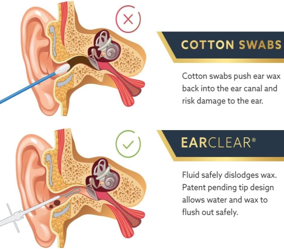 Ear Wax Remover, 20in1 Ear Cleaner Kit with Olive Oil Ear Drops for blocked ears, easy safe