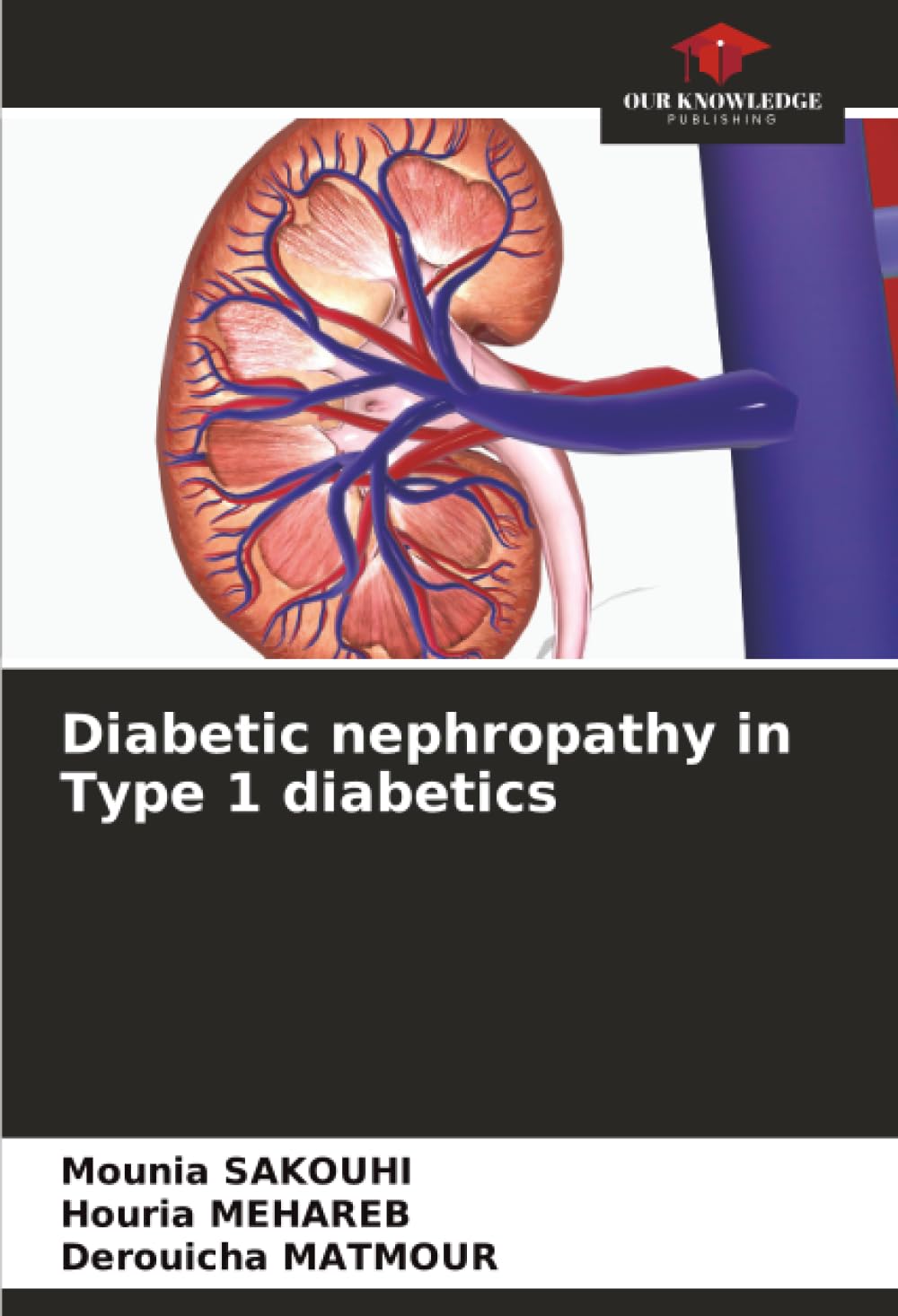 Diabetic nephropathy in Type 1 diabetics