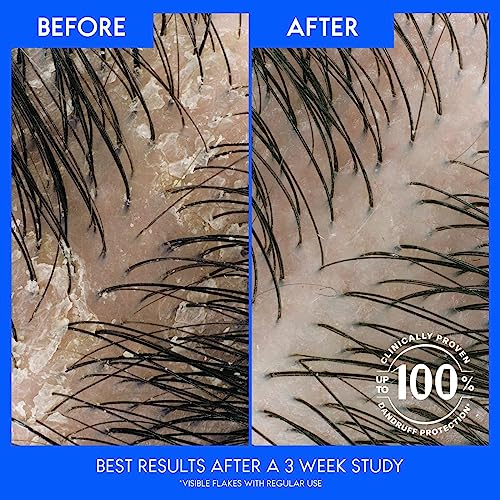 Image of Head & Shoulders Anti-Dandruff Shampoo and Conditioner for Women | Smooth & Silky 2-in-1 Value Pack | 1% Pyrithione Zinc, 24-Hour Frizz Control, Soothes Dry & Itchy Scalp, 31.4 Fl Oz Each, Twin Pack