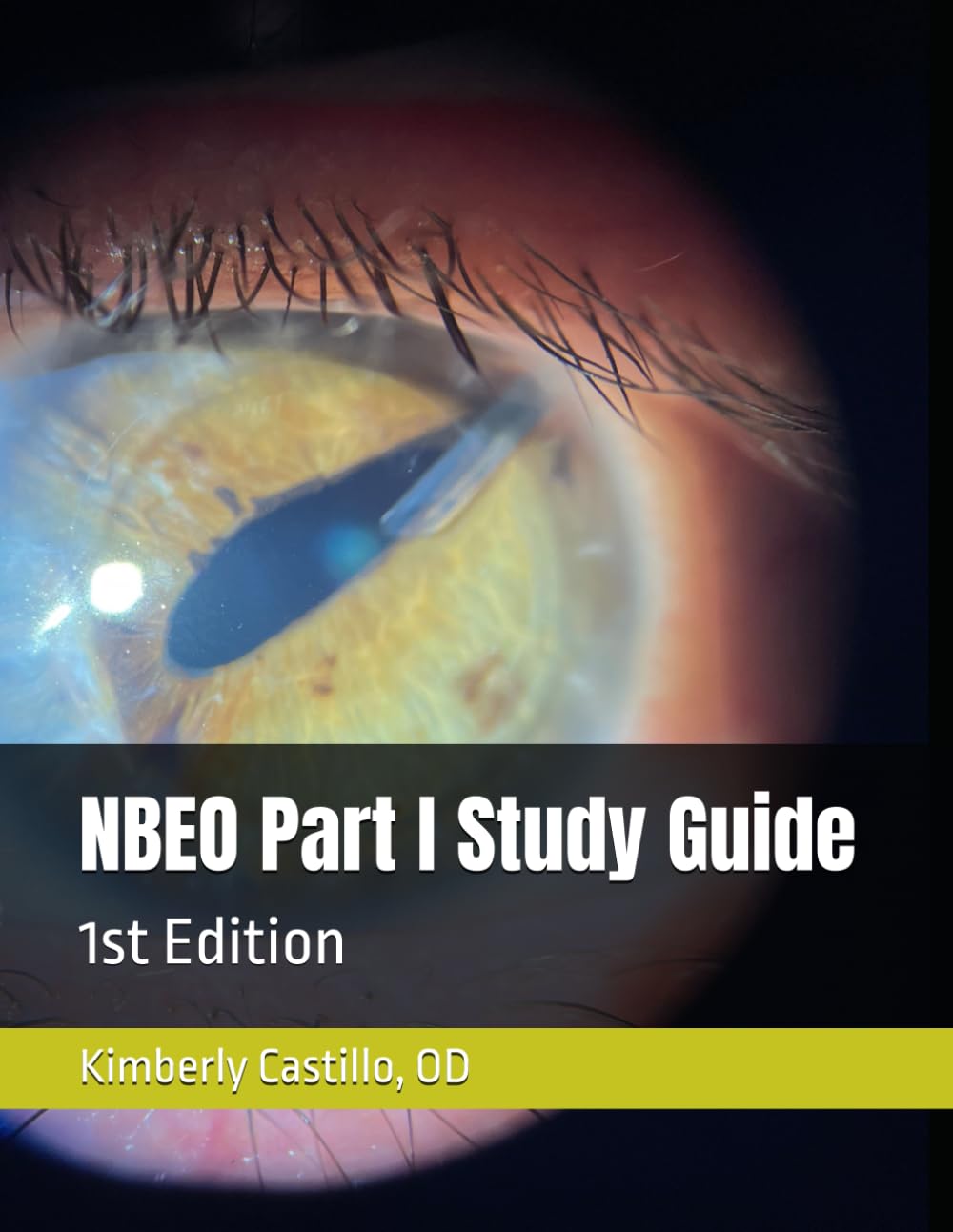 NBEO Part I Study Guide: 1st Edition