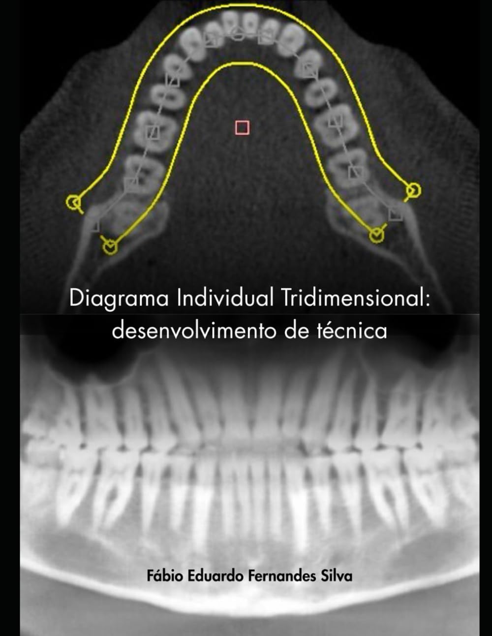 DIAGRAMA INDIVIDUAL TRIDIMENSIONAL:: DESENVOLVIMENTO DE TÉCNICA (FUNDAMENTOS DA ORTODONTIA)