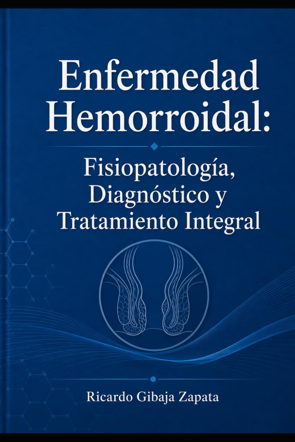 Enfermedad Hemorroidal: Fisiopatología, Diagnóstico y Tratamiento Integral