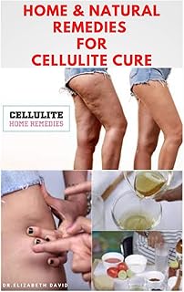 HOME & NATURAL REMEDIES FOR CELLULITE CURE: Practical Guide On The Best Remedies To Get Rid Of Your Cellulite : Everything...