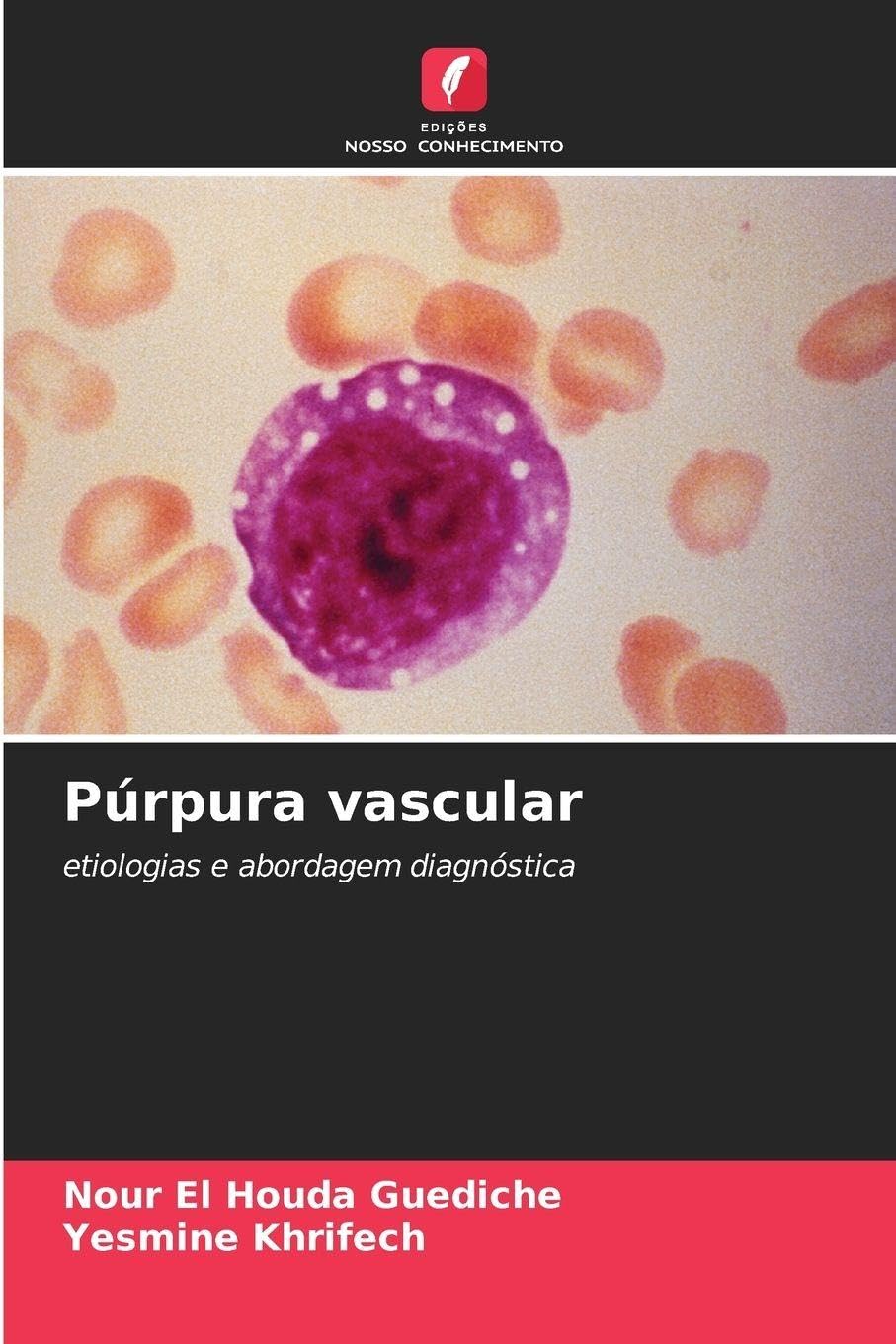 Púrpura vascular: etiologias e abordagem diagnóstica