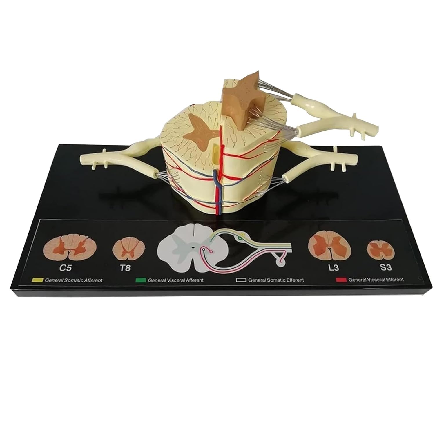 YNIYUJKL Human Spinal Cord Anatomical Model, 5X Spinal Cord Nerve Anatomy Model, Including Vertebral, Nerve Branches,Ganglion& Blood Vessels,For Medical Teaching Study Display